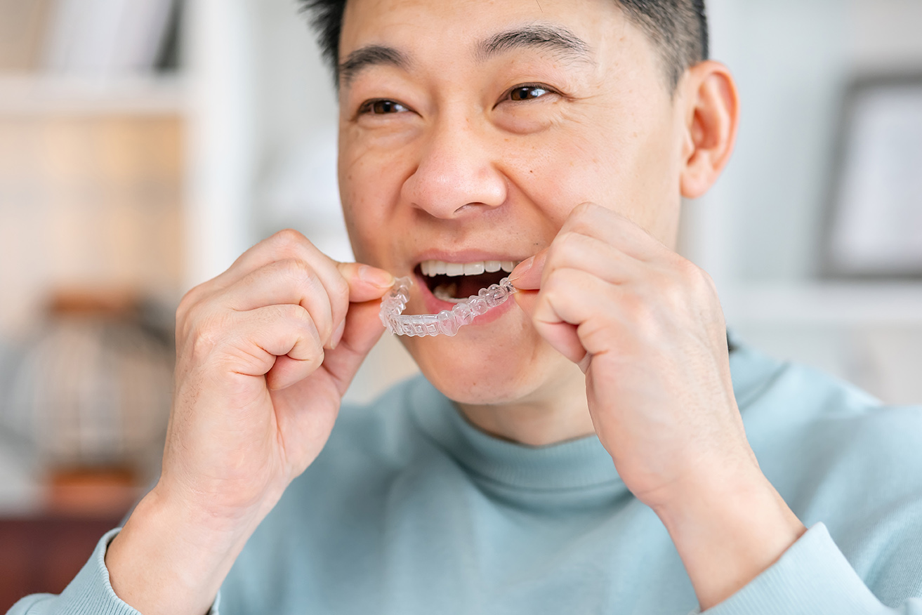 male placing invisalign in his mouth after clear aligner appointment at chesterfield dental studio